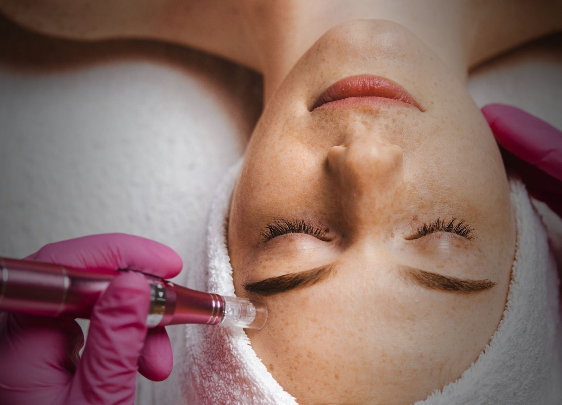 Dermapen